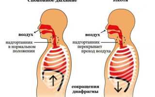 Как остановить икоту после алкоголя быстро и эффективно