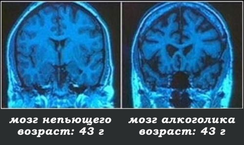 Польза и вред пива для мужчин