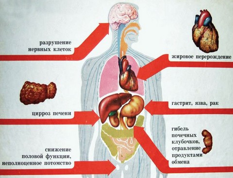 Если изжога после алкоголя