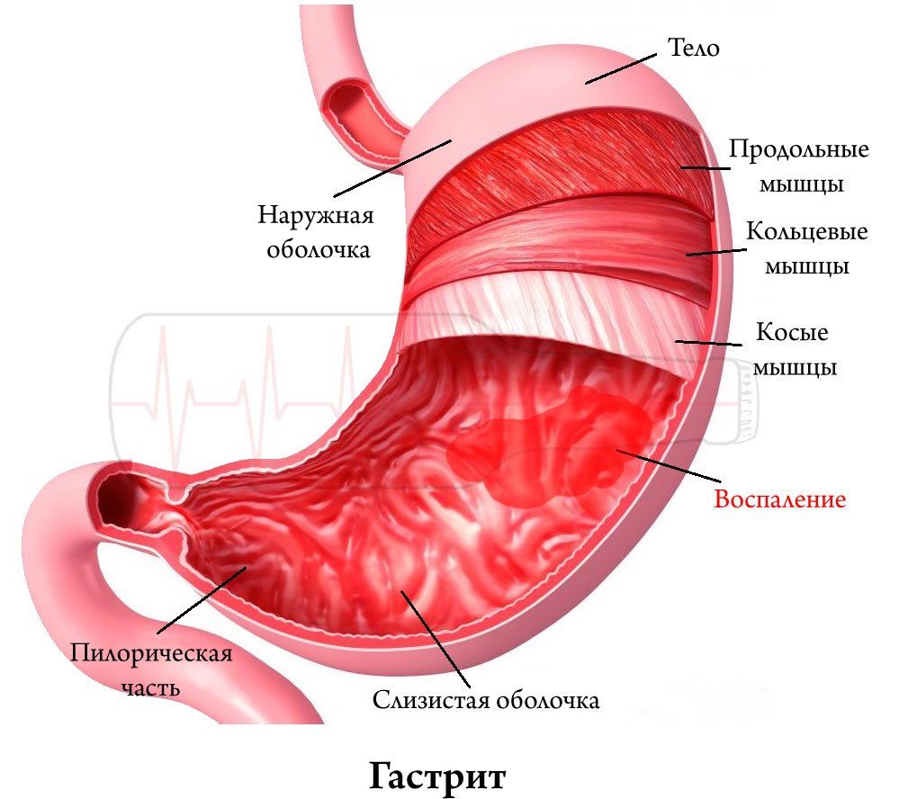 Можно ли совмещать Аспирин с алкоголем