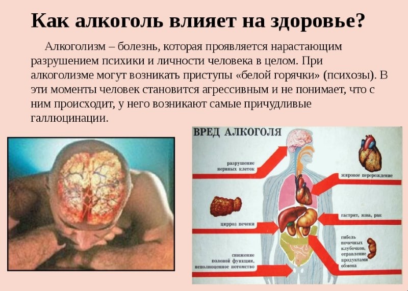 Мозг после злоупотребления алкоголем. Возможно ли восстановление