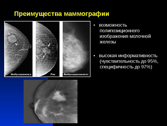 Можно ли алкоголь перед сдачей анализов