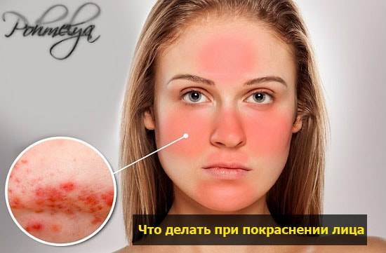 Если краснеет лицо от употребления алкоголя