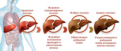Почему люди пьют спиртное