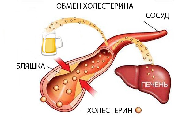 Можно ли алкоголь при холецистите